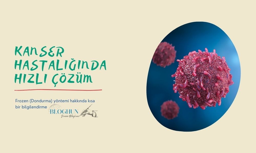 Kanser Tanısında Frozen Yöntemi